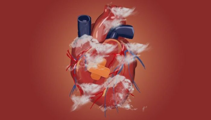 Gejala dan Penyebab Penyakit Jantung Bawaan pada Anak