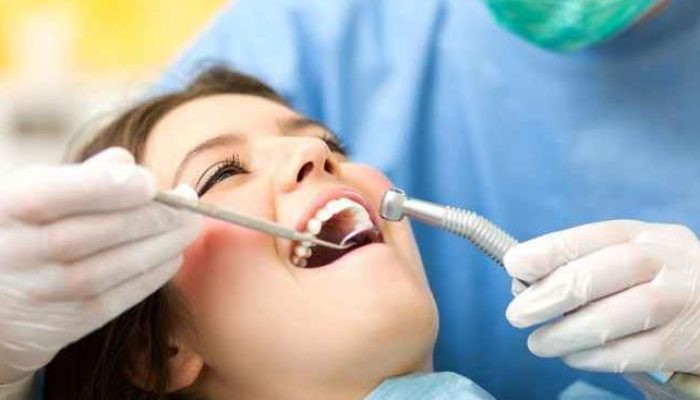 Scaling Gigi Gratis Pakai BPJS Kesehatan, Simak Cara dan Syaratnya