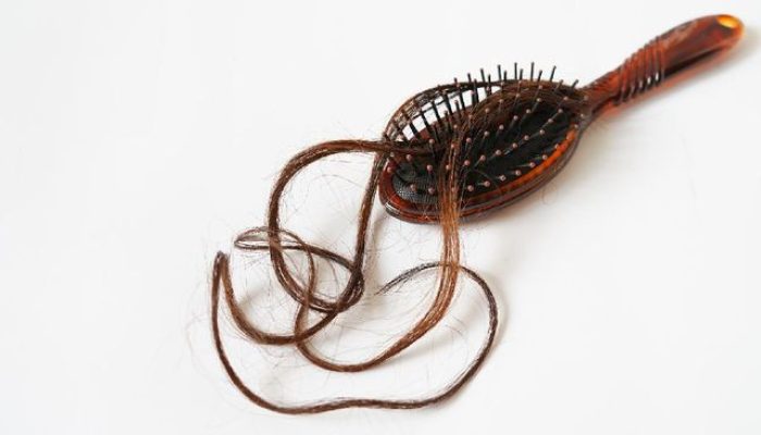 Perawatan Rambut Rontok Usulan Penanggungan oleh Negara